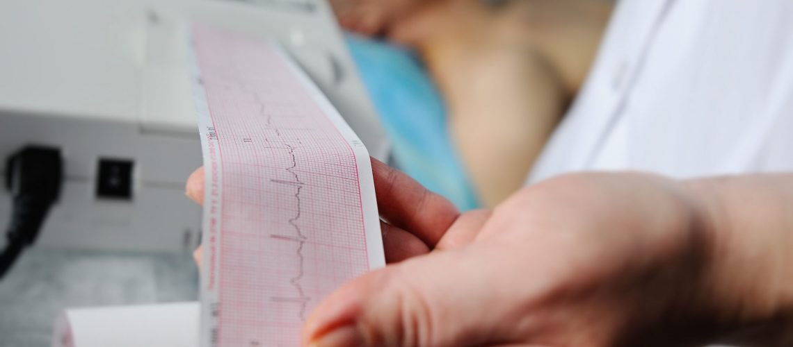 doctor with electrocardiogram equipment making cardiogram test to male patient in hospital clinic